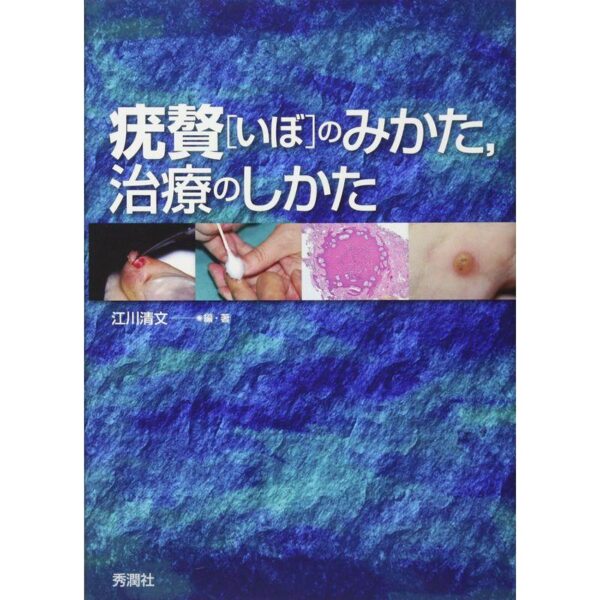疣贅(いぼ)のみかた，治療のしかた